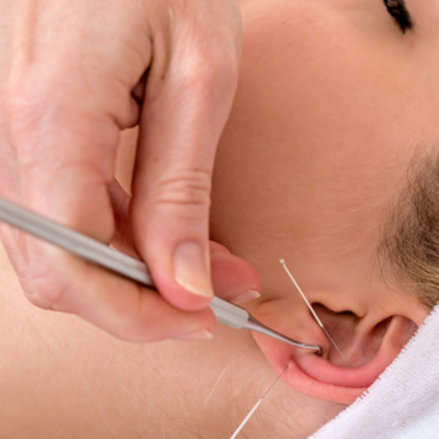 Ear Lobe surgery